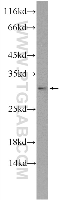 Western Blot (WB) analysis of MCF-7 cells using TSN Polyclonal antibody (55426-1-AP)
