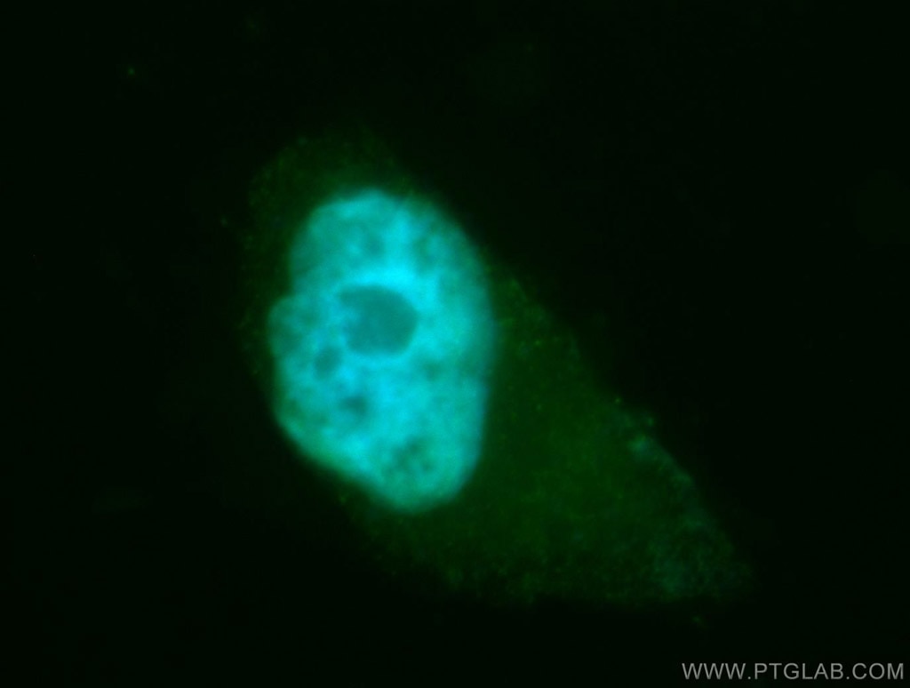 Immunofluorescence (IF) / fluorescent staining of MCF-7 cells using TSNAX Polyclonal antibody (11040-1-AP)