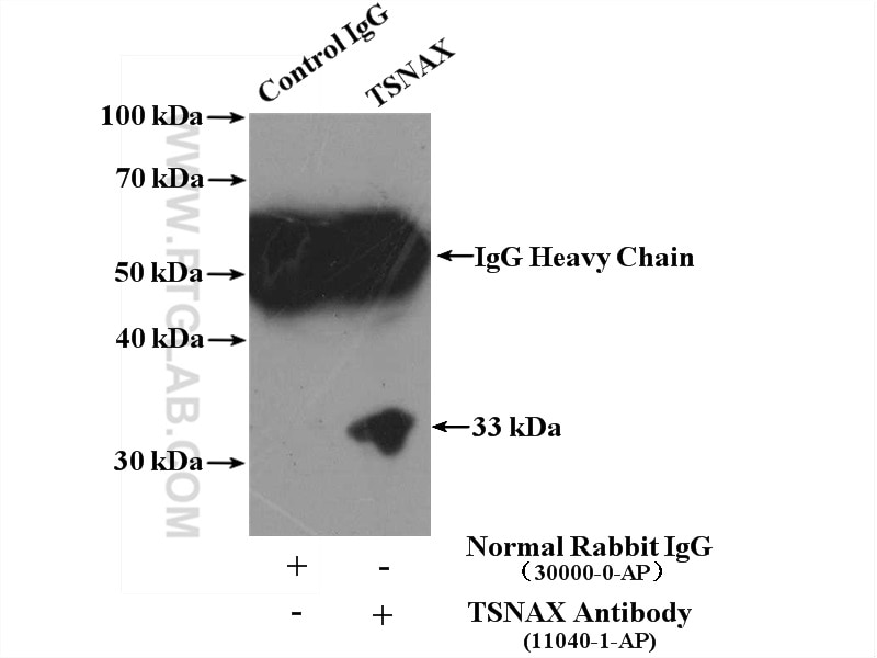 Immunoprecipitation (IP) experiment of HeLa cells using TSNAX Polyclonal antibody (11040-1-AP)