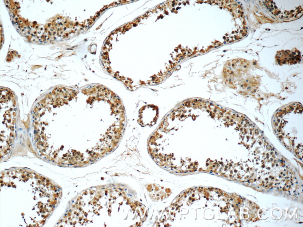 Immunohistochemistry (IHC) staining of human testis tissue using TSNAXIP1 Polyclonal antibody (17730-1-AP)
