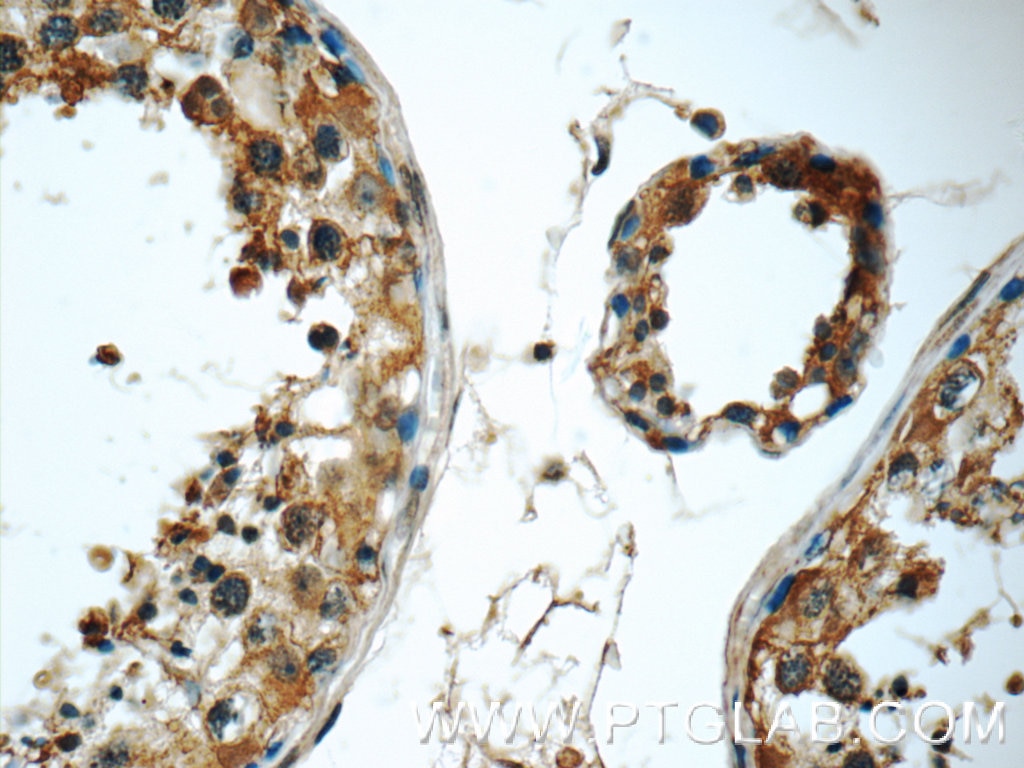 Immunohistochemistry (IHC) staining of human testis tissue using TSNAXIP1 Polyclonal antibody (17730-1-AP)