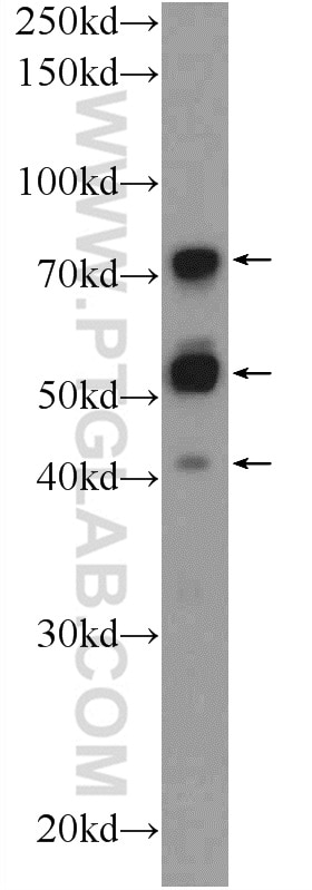 Western Blot (WB) analysis of mouse testis tissue using TSNAXIP1 Polyclonal antibody (17730-1-AP)