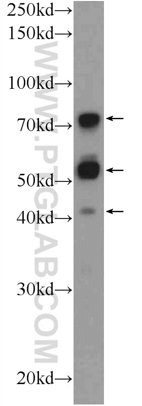 WB analysis of mouse testis using 17730-1-AP