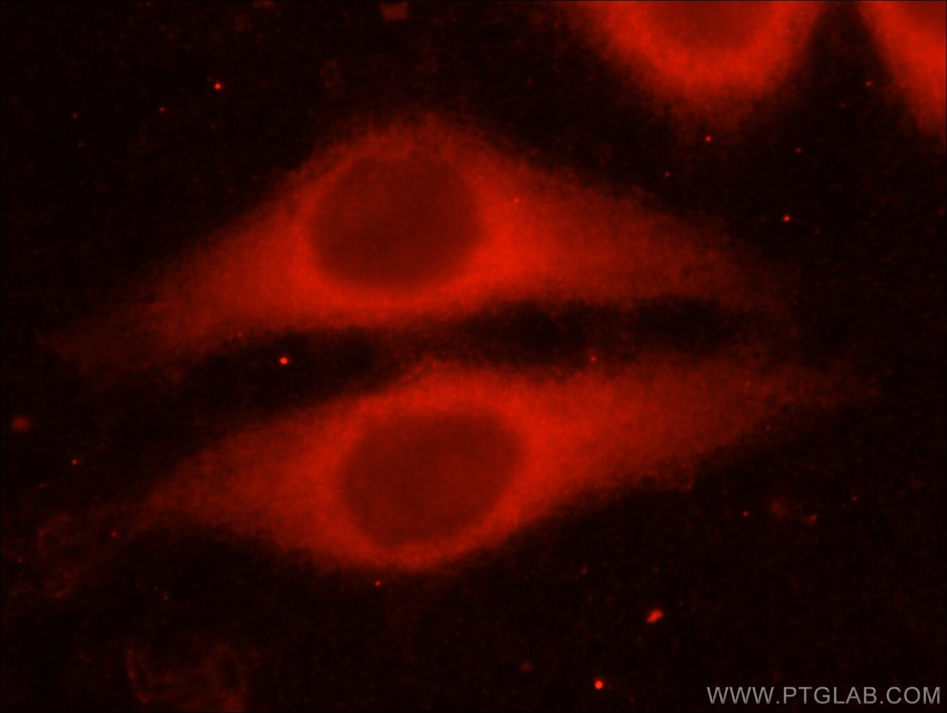 Thrombospondin 1 Polyclonal antibody