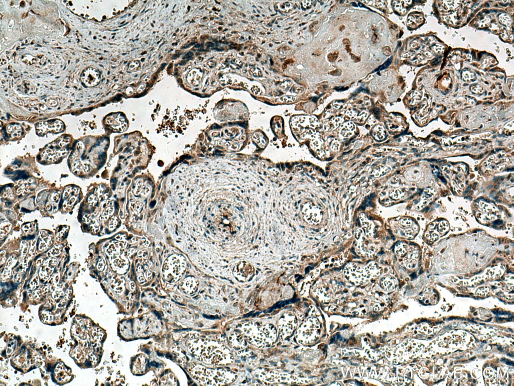 Immunohistochemistry (IHC) staining of human placenta tissue using Thrombospondin 1 Polyclonal antibody (18304-1-AP)