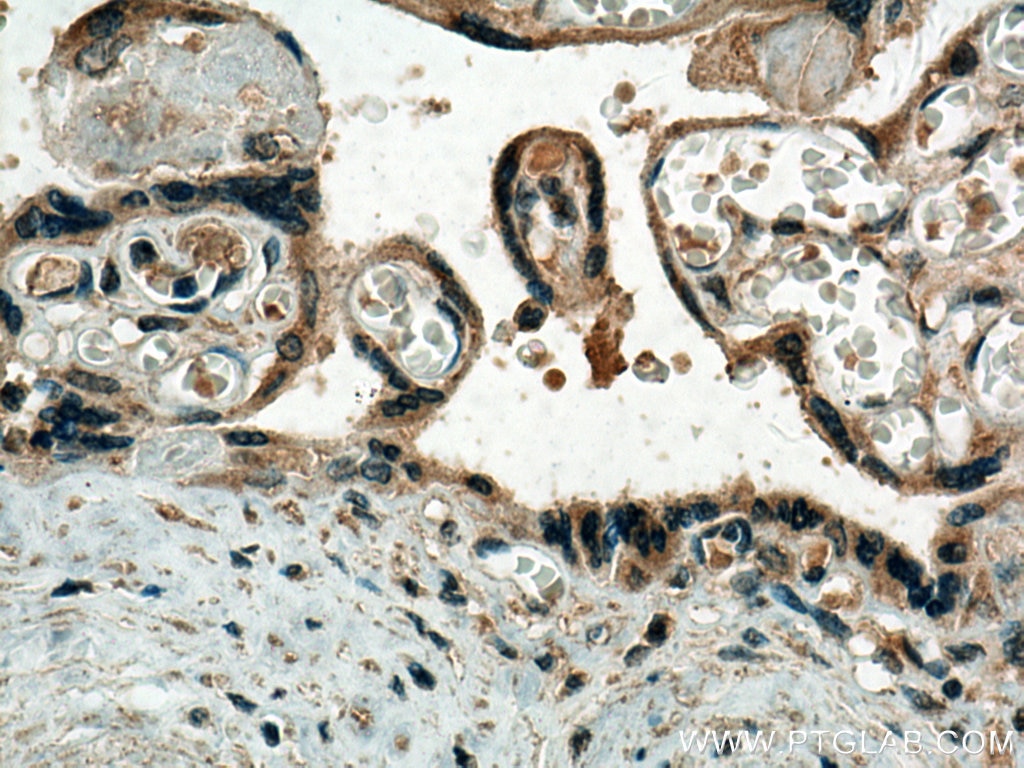 Immunohistochemistry (IHC) staining of human placenta tissue using Thrombospondin 1 Polyclonal antibody (18304-1-AP)