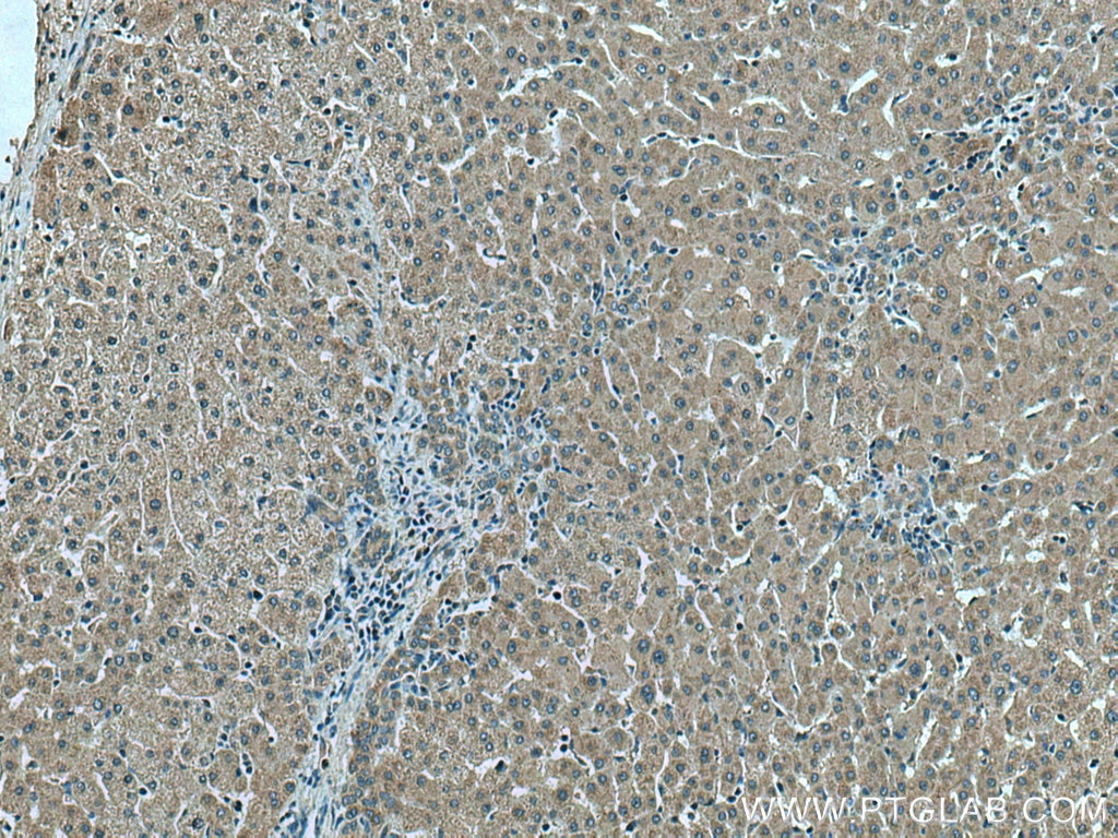 Immunohistochemistry (IHC) staining of human liver tissue using Thrombospondin 1 Polyclonal antibody (18304-1-AP)