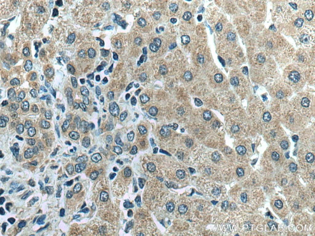 Immunohistochemistry (IHC) staining of human liver tissue using Thrombospondin 1 Polyclonal antibody (18304-1-AP)