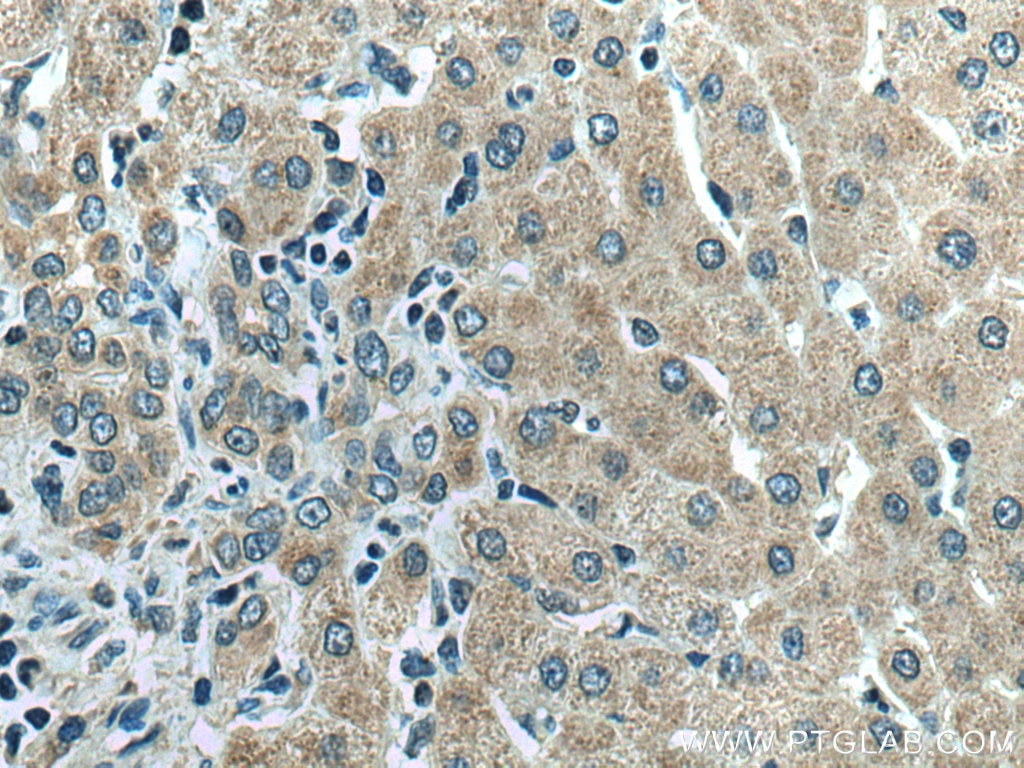 IHC staining of human liver using 18304-1-AP