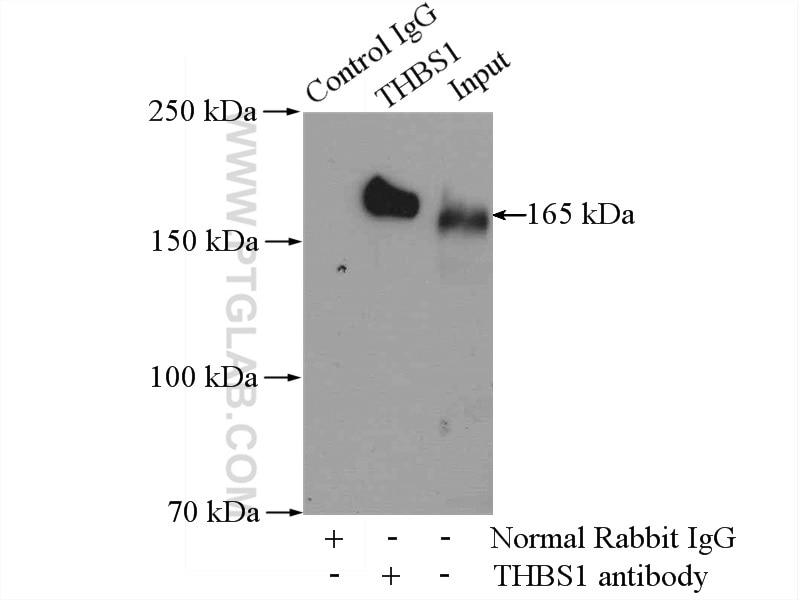 Thrombospondin 1 Polyclonal antibody