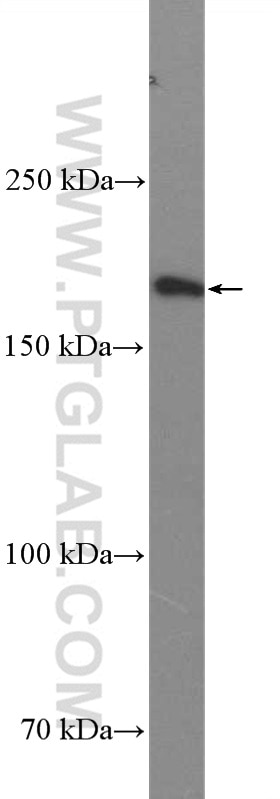 Western Blot (WB) analysis of A431 cells using Thrombospondin 1 Polyclonal antibody (18304-1-AP)