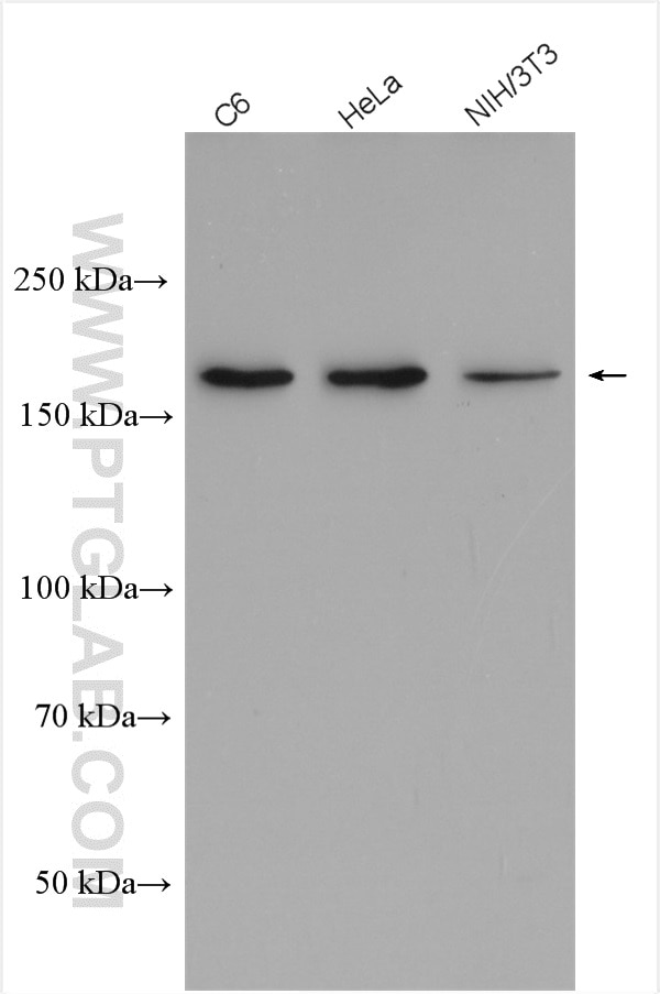 Western Blot (WB) analysis of various lysates using Thrombospondin 1 Polyclonal antibody (18304-1-AP)