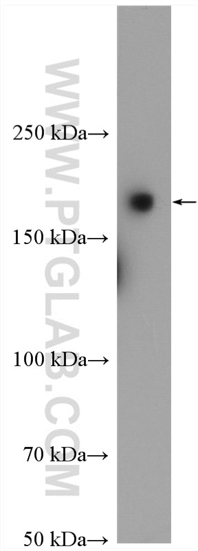 WB analysis of human peripheral blood platelets using 18304-1-AP