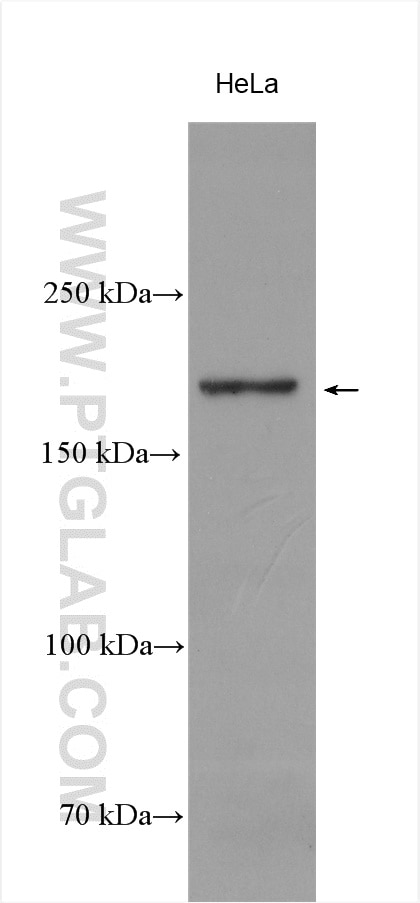 Western Blot (WB) analysis of HeLa cells using Thrombospondin 1 Polyclonal antibody (18304-1-AP)