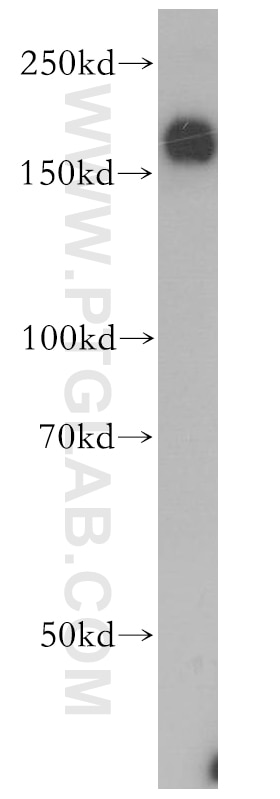 Thrombospondin 1 Polyclonal antibody