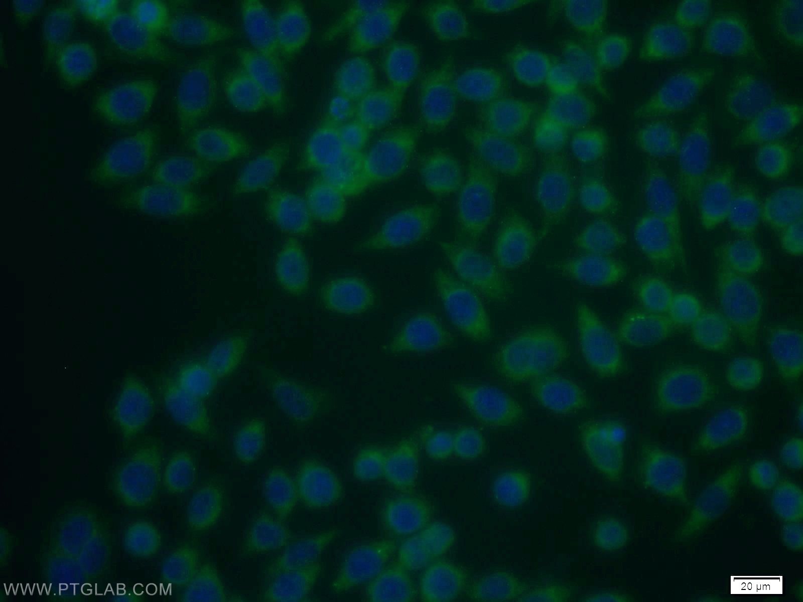 Immunofluorescence (IF) / fluorescent staining of MCF-7 cells using TSP50 Polyclonal antibody (12574-1-AP)