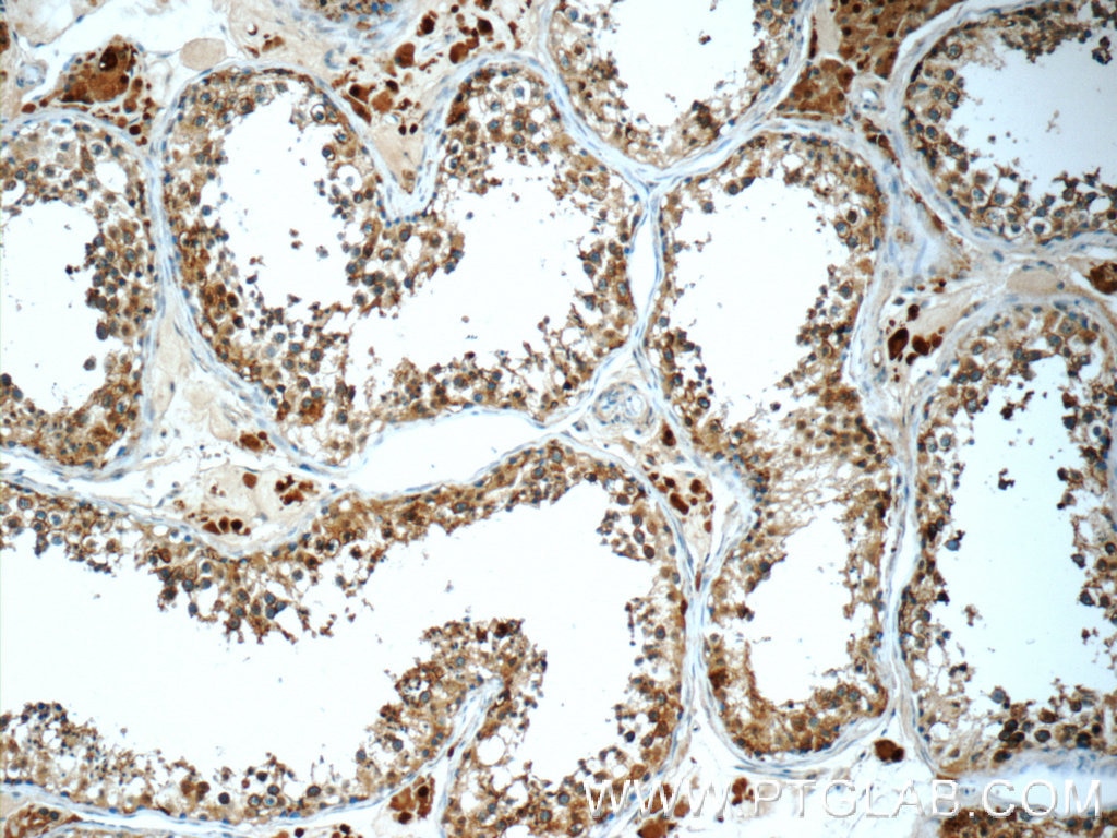 Immunohistochemistry (IHC) staining of human testis tissue using TSP50 Polyclonal antibody (12574-1-AP)
