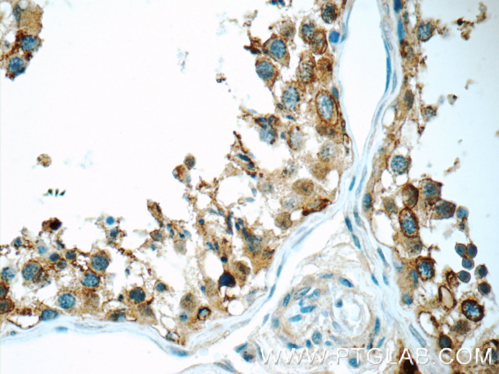 Immunohistochemistry (IHC) staining of human testis tissue using TSP50 Polyclonal antibody (12574-1-AP)
