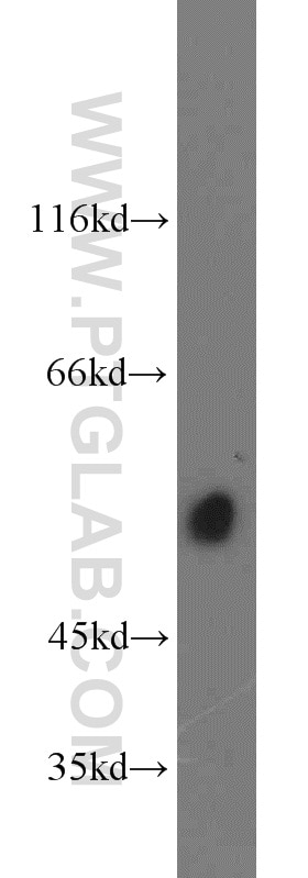 Western Blot (WB) analysis of HEK-293 cells using TSP50 Polyclonal antibody (12574-1-AP)