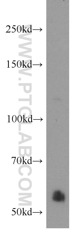 Western Blot (WB) analysis of human testis tissue using TSP50 Polyclonal antibody (12574-1-AP)