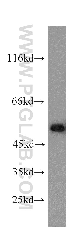Western Blot (WB) analysis of MCF-7 cells using TSP50 Polyclonal antibody (12574-1-AP)