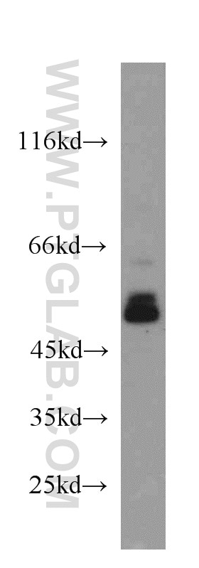 Western Blot (WB) analysis of MCF-7 cells using TSP50 Polyclonal antibody (12574-1-AP)