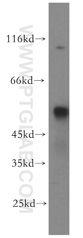 Western Blot (WB) analysis of MCF-7 cells using TSP50 Polyclonal antibody (12574-1-AP)