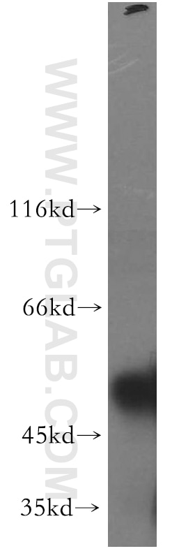 Western Blot (WB) analysis of mouse testis tissue using TSP50 Polyclonal antibody (12574-1-AP)