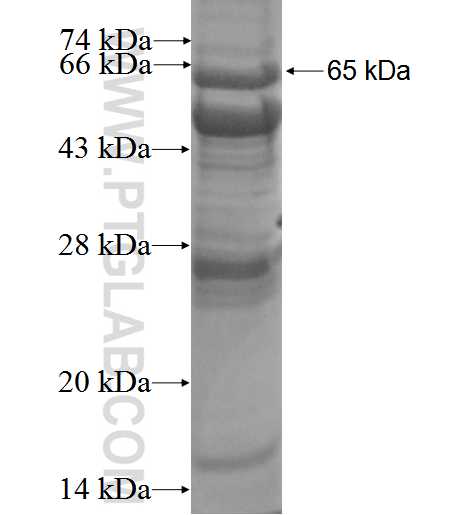 TSP50 fusion protein Ag3247 SDS-PAGE