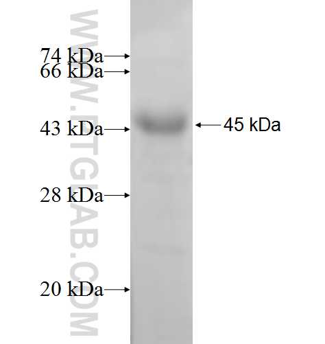 TSP50 fusion protein Ag8291 SDS-PAGE TSP50 fusion protein Ag8291 SDS-PAGE