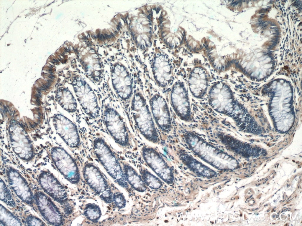 Immunohistochemistry (IHC) staining of human colon tissue using TSPAN1 Polyclonal antibody (16058-1-AP)