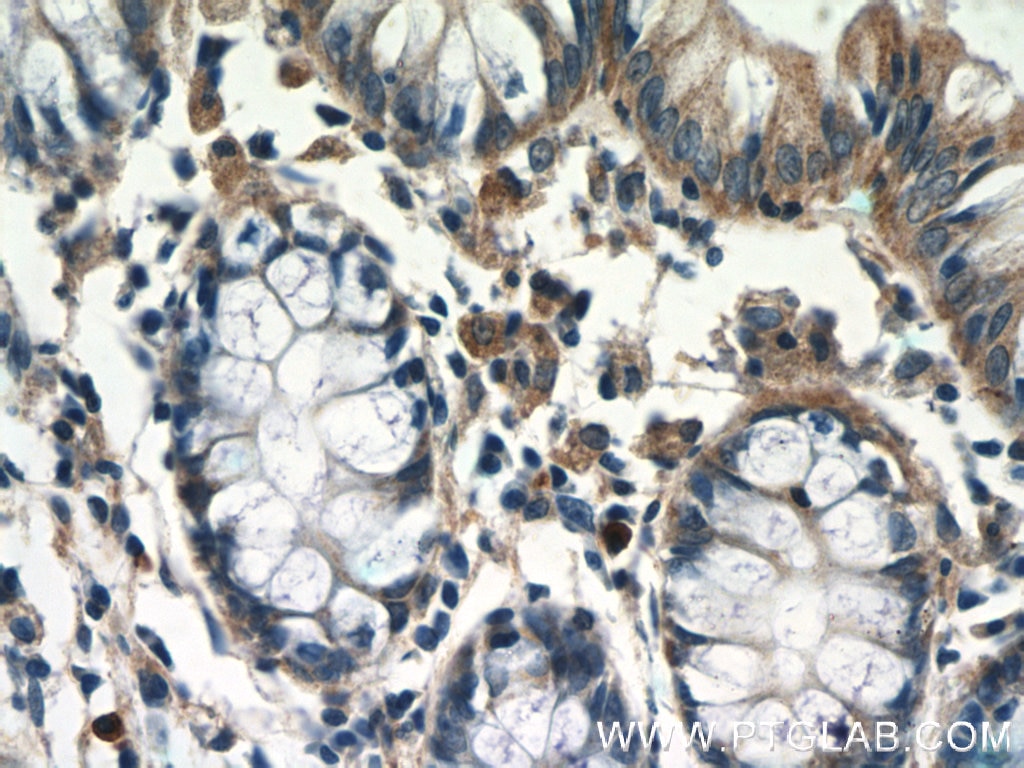 Immunohistochemistry (IHC) staining of human colon tissue using TSPAN1 Polyclonal antibody (16058-1-AP)