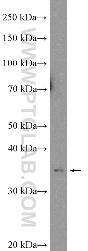 Western Blot (WB) analysis of rat colon tissue using TSPAN1 Polyclonal antibody (16058-1-AP)