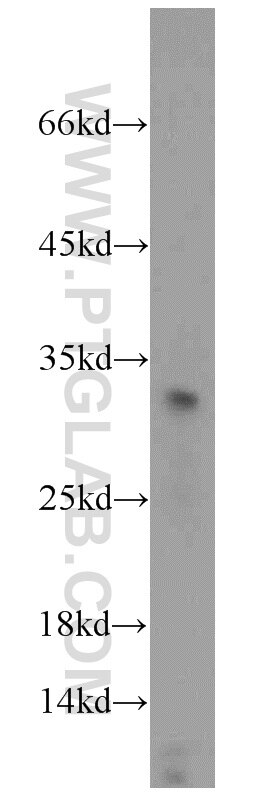 Western Blot (WB) analysis of COLO 320 cells using TSPAN1 Polyclonal antibody (16058-1-AP)