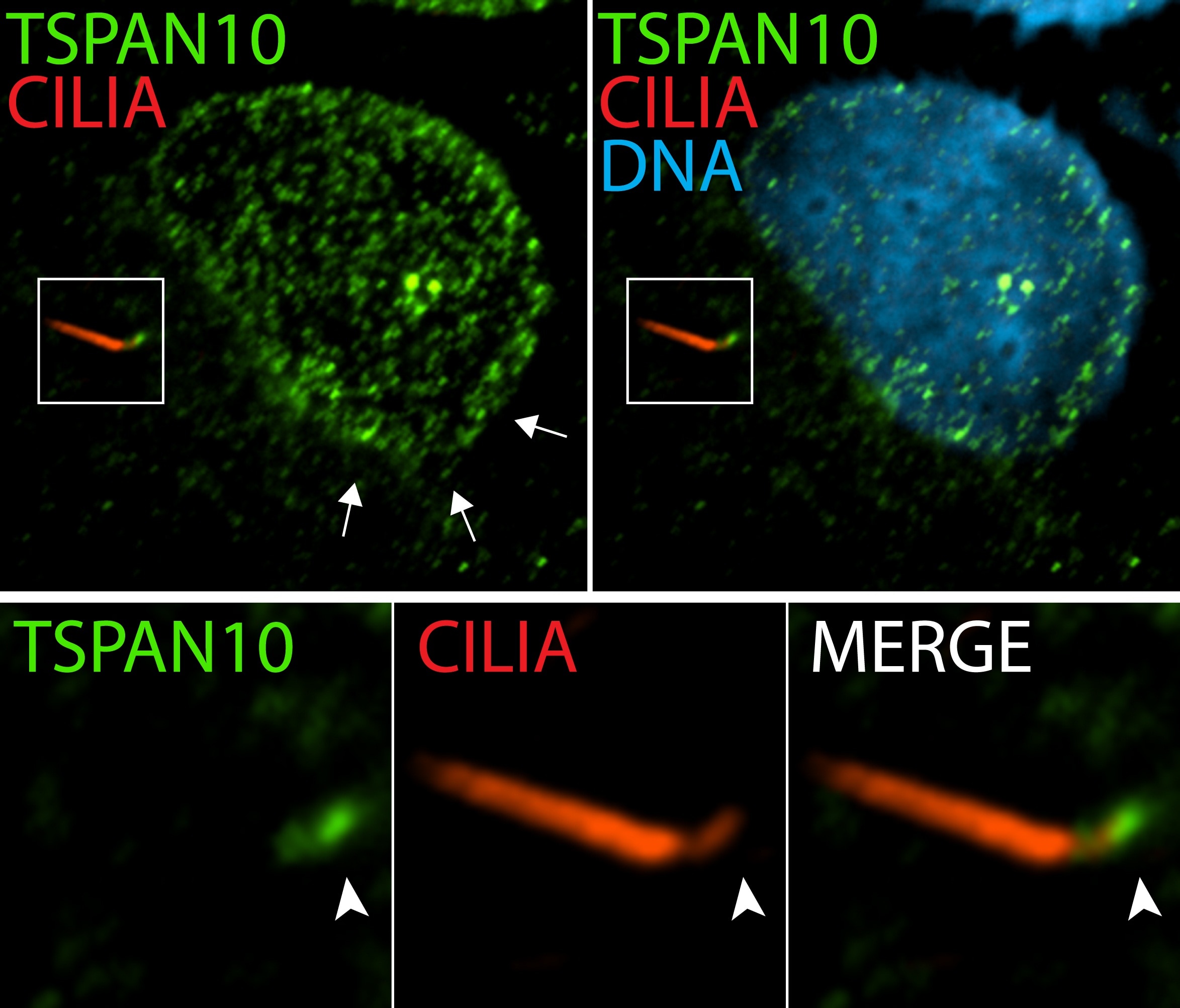 Immunofluorescence (IF) / fluorescent staining of hTERT-RPE1 cells using TSPAN10 Polyclonal antibody (14430-1-AP)