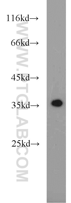 Western Blot (WB) analysis of mouse brain tissue using TSPAN11 Polyclonal antibody (18807-1-AP)