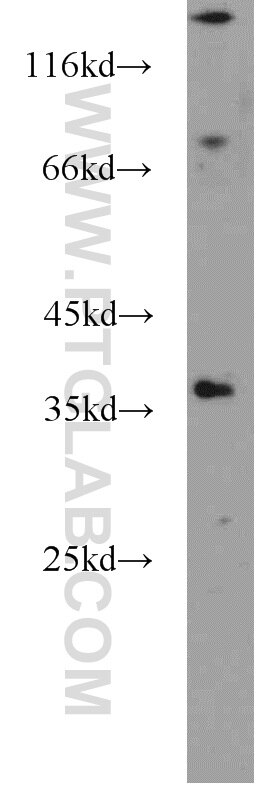 Western Blot (WB) analysis of human brain tissue using TSPAN11 Polyclonal antibody (18807-1-AP)