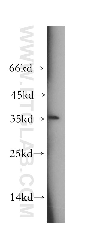 Western Blot (WB) analysis of human brain tissue using TSPAN11 Polyclonal antibody (18807-1-AP)