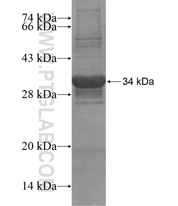 TSPAN11 fusion protein Ag17137 SDS-PAGE