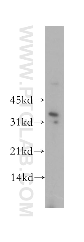 Western Blot (WB) analysis of MCF-7 cells using TSPAN12 Polyclonal antibody (12812-1-AP)