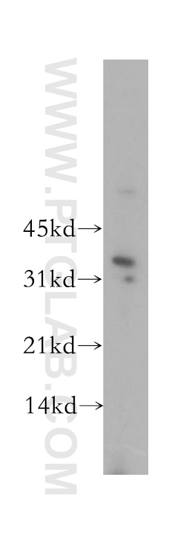 WB analysis of MCF-7 using 12812-1-AP