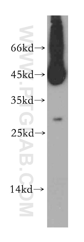 WB analysis of HepG2 using 12812-1-AP