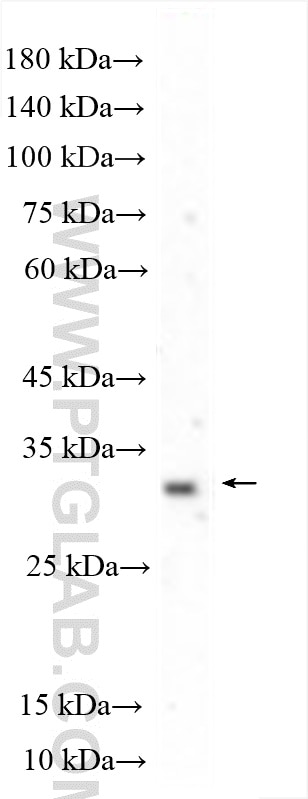 Western Blot (WB) analysis of A549 cells using TSPAN14 Polyclonal antibody (15314-1-AP)