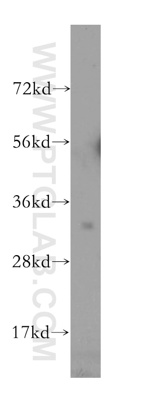 Western Blot (WB) analysis of human ovary cancer cells using TSPAN15 Polyclonal antibody (10460-1-AP)