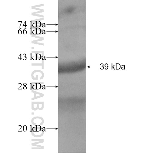 TSPAN17 fusion protein Ag14157 SDS-PAGE