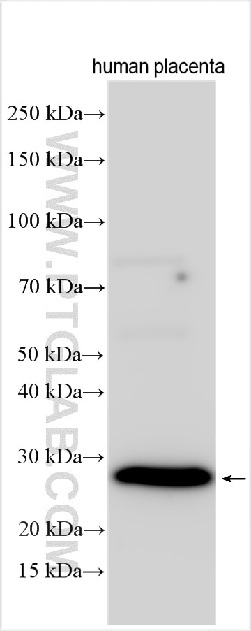 Western Blot (WB) analysis of various lysates using TSPAN18 Polyclonal antibody (15919-1-AP)