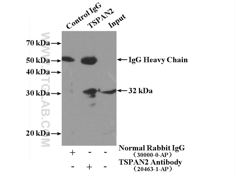 Immunoprecipitation (IP) experiment of HL-60 cells using TSPAN2 Polyclonal antibody (20463-1-AP)