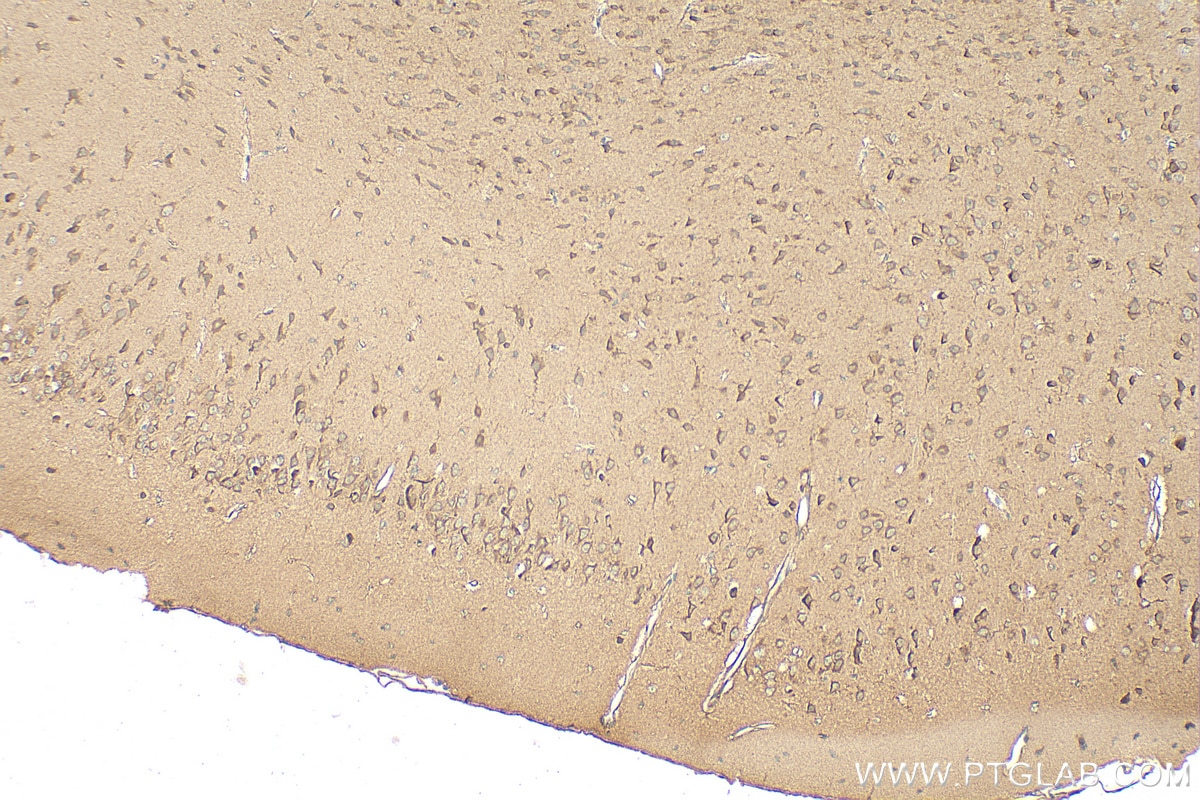 Immunohistochemistry (IHC) staining of mouse brain tissue using TSPAN3 Polyclonal antibody (13036-1-AP)