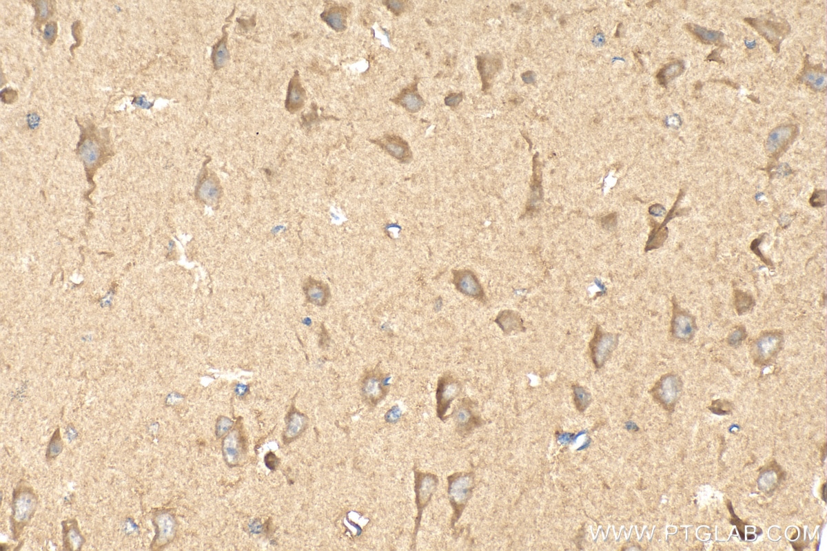 Immunohistochemistry (IHC) staining of mouse brain tissue using TSPAN3 Polyclonal antibody (13036-1-AP)