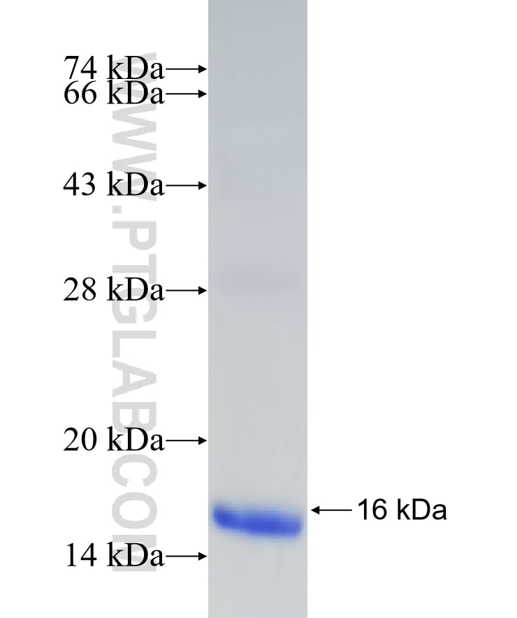 TSPAN3 fusion protein Ag32905 SDS-PAGE TSPAN3 fusion protein Ag32905 SDS-PAGE